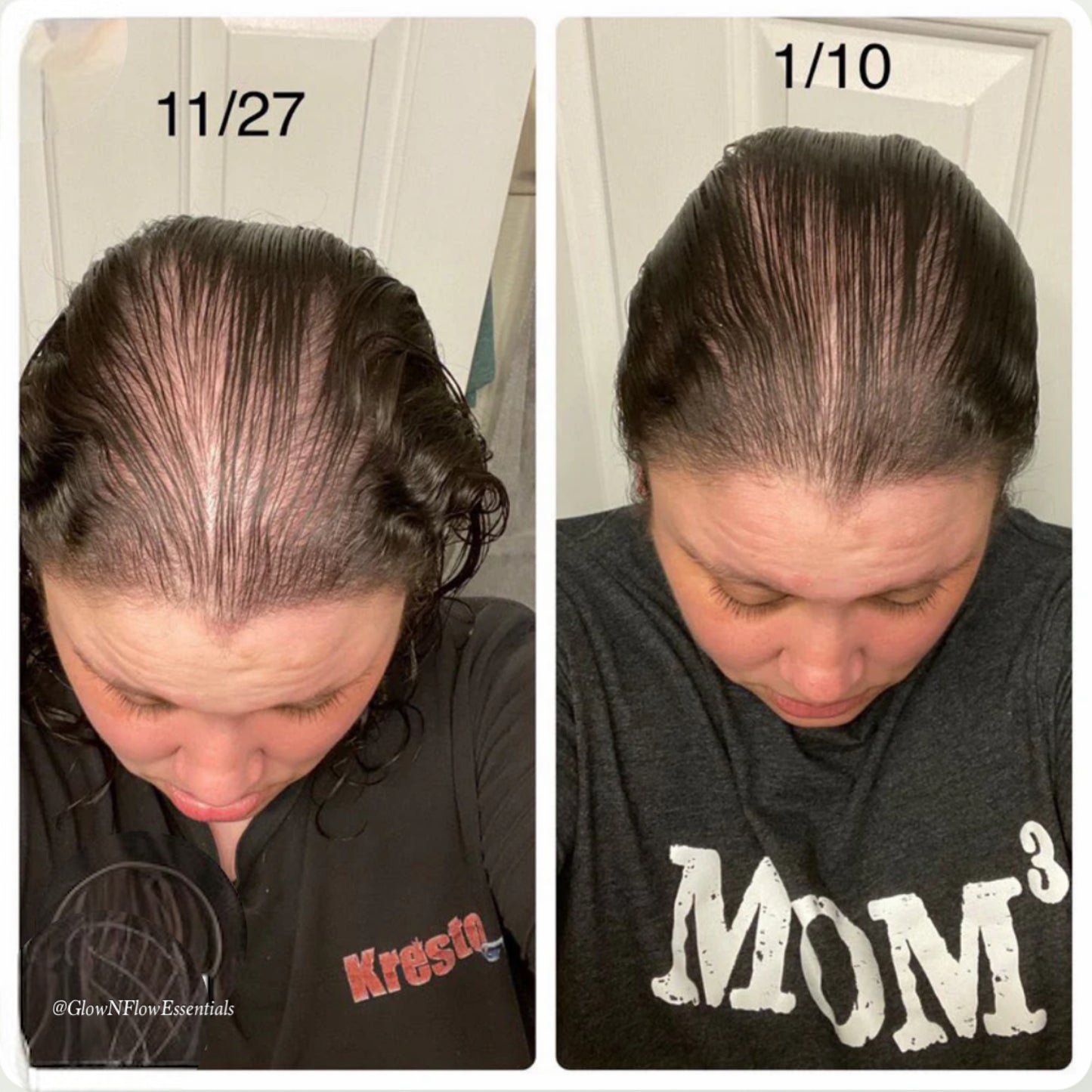 Hair Growth Oil